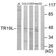 Western blot analysis of extracts from Jurkat cells, COLO205 cells, 293 cells and HepG2 cells, using TR19L antibody.