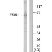 Western blot analysis of extracts from COLO205 cells, using ES8L1 antibody.