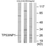 Western blot analysis of extracts from COLO205 cells, HUVEC cells and HepG2 cells, using TP53INP1 antibody.