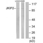 Western blot analysis of extracts from LOVO cells and A549 cells, using JKIP2 antibody.