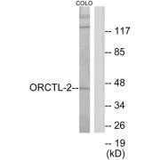 Western blot analysis of extracts from COLO205 cells, using ORCTL-2 antibody.