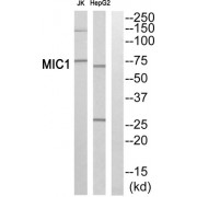 Western blot analysis of extracts from Jurkat cells and HepG2 cells, using MIC1 antibody.