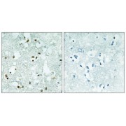 Immunohistochemistry analysis of paraffin-embedded human brain tissue, using ELAC2 antibody.