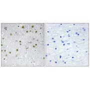 Immunohistochemistry analysis of paraffin-embedded human brain tissue, using NRIP2 antibody.