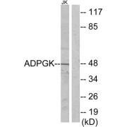 Western blot analysis of extracts from Jurkat cells, using ADPGK antibody.