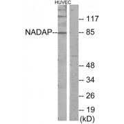 Western blot analysis of extracts from HUVEC cells, using NADAP antibody.