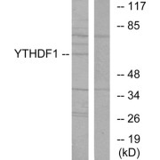 Western blot analysis of extracts from 293 cells, using YTHDF1 antibody.