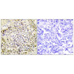 Iroquois Homeobox 2 (IRX2) Antibody