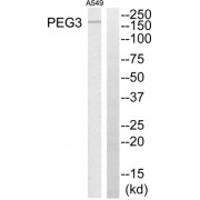 Western blot analysis of extracts from A549 cells, using PEG3 antibody.