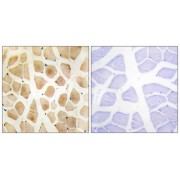 Immunohistochemistry analysis of paraffin-embedded human skeletal muscle tissue using SLK antibody.