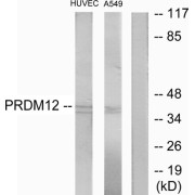 Western blot analysis of extracts from HUVEC cells and A549 cells, using PRDM12 antibody.