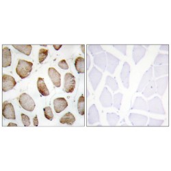 tRNA-Dihydrouridine(20) Synthase [NAD(P)+]-Like (DUS2L) Antibody