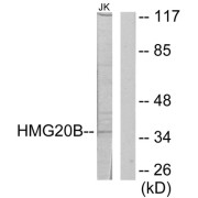 Western blot analysis of extracts from Jurkat cells, using HMG20B antibody.