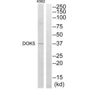 Western blot analysis of extracts from K562 cells, using DOK5 antibody.