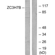 Western blot analysis of extracts from 293 cells, using ZC3H7B antibody.