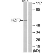 Western blot analysis of extracts from COLO cells, using IKZF3 antibody.