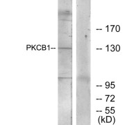 Western blot analysis of extracts from 293 cells, using PKCB1 antibody.