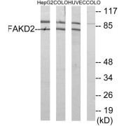 Western blot analysis of extracts from HepG2 cells, COLO cells and HUVEC cells, using FAKD2 antibody.