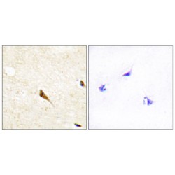 MAPK/MAK/MRK Overlapping Kinase (MOK) Antibody