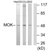 Western blot analysis of extracts from HepG2 cells, COLO205 cells and 293 cells, using MOK antibody.