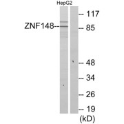 Western blot analysis of extracts from HepG2 cells, using ZNF148 antibody.