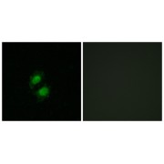 Immunofluorescence analysis of A549 cells, using ZNF95 antibody.