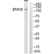 Western blot analysis of extracts from K562 cells, using STA13 antibody.