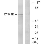 Western blot analysis of extracts from Jurkat cells, using DYR1B antibody.