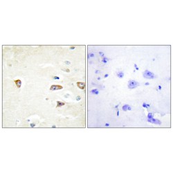 Myotonic Dystrophy Kinase-Related CDC42-Binding Kinase Beta (MRCKB) Antibody