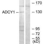 Western blot analysis of extracts from COLO205 cells, using ADCY1 antibody.