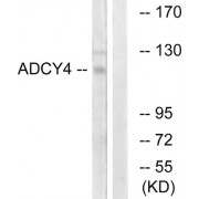 Western blot analysis of extracts from Jurkat cells, using ADCY4 antibody.