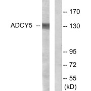 Western blot analysis of extracts from COLO205 cells, using ADCY5 antibody.