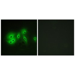 Adenylate Cyclase Type 8 (ADCY8) Antibody