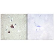 Immunohistochemistry analysis of paraffin-embedded human brain tissue, using ADCY8 antibody.