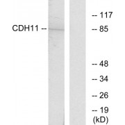 Western blot analysis of extracts from Jurkat cells, using CDH11 antibody. The right lane is blocked with peptide.