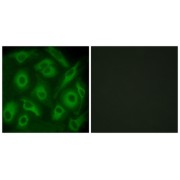 Immunofluorescence analysis of HeLa cells, using CDH23 antibody.