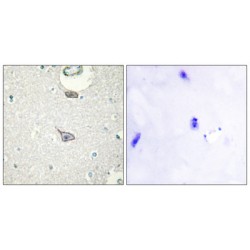Cell Adhesion Molecule 4 (CADM4) Antibody