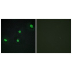 Cell Division Cycle Associated 4 (CDCA4) Antibody