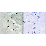 Immunohistochemistry analysis of paraffin-embedded human brain tissue using CDCA4 antibody.