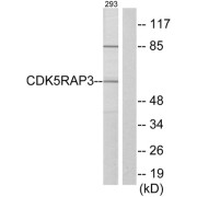 Western blot analysis of extracts from 293 cells, using CDK5RAP3 antibody.