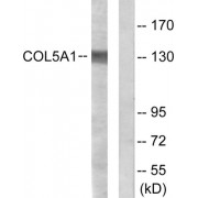 Western blot analysis of extracts from HeLa cells, using COL5A1 antibody.