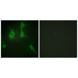 Collagen Type IX Alpha 3 (COL9A3) Antibody