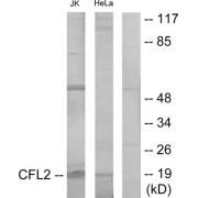 Western blot analysis of extracts from Jurkat cells and HeLa cells, using Cofilin antibody.