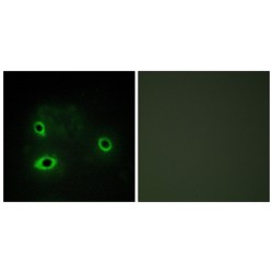 Cytochrome C Oxidase Subunit IV Isoform 2 (COX42) Antibody