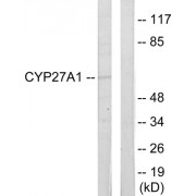 Western blot analysis of extracts from HeLa cells, using CYP27A1 antibody.