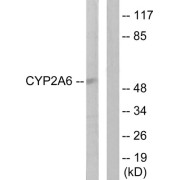 Western blot analysis of extracts from Jurkat cells, using CYP2A6 antibody.