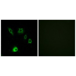 Fibroblast Growth Factor 18 (FGF18) Antibody