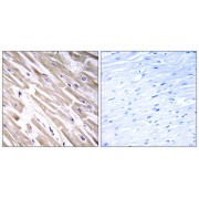 Immunohistochemistry analysis of paraffin-embedded human heart tissue using FGF18 antibody.