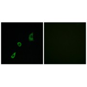 Immunofluorescence analysis of HuvEc cells, using FGF23 antibody. The image on the right is blocked with the synthesized peptide.