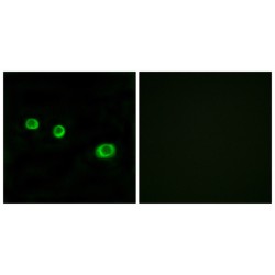 Guanylate-Binding Protein 1 (GBP1) Antibody